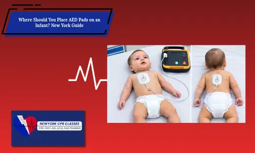 infant aed pad anterior posterior placement